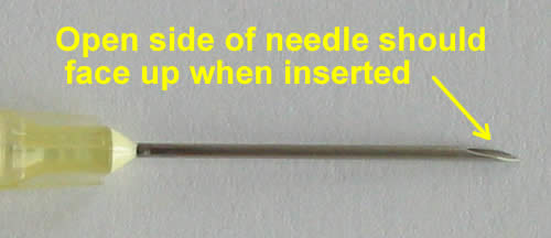 Name:  Sophia needle_opening.jpg
Views: 927
Size:  14.2 KB