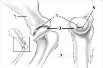 osteochondrosis treatment in humans